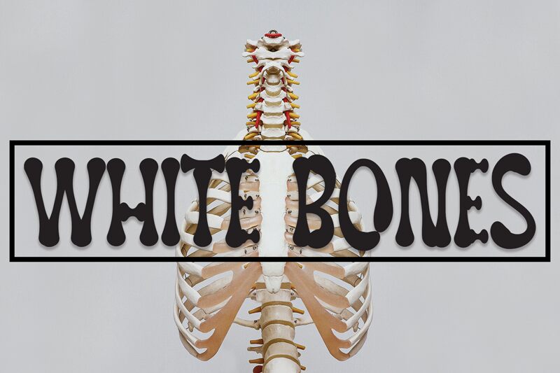 White Bones